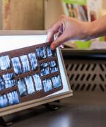 Image of dental x-ray being viewed on a light box.